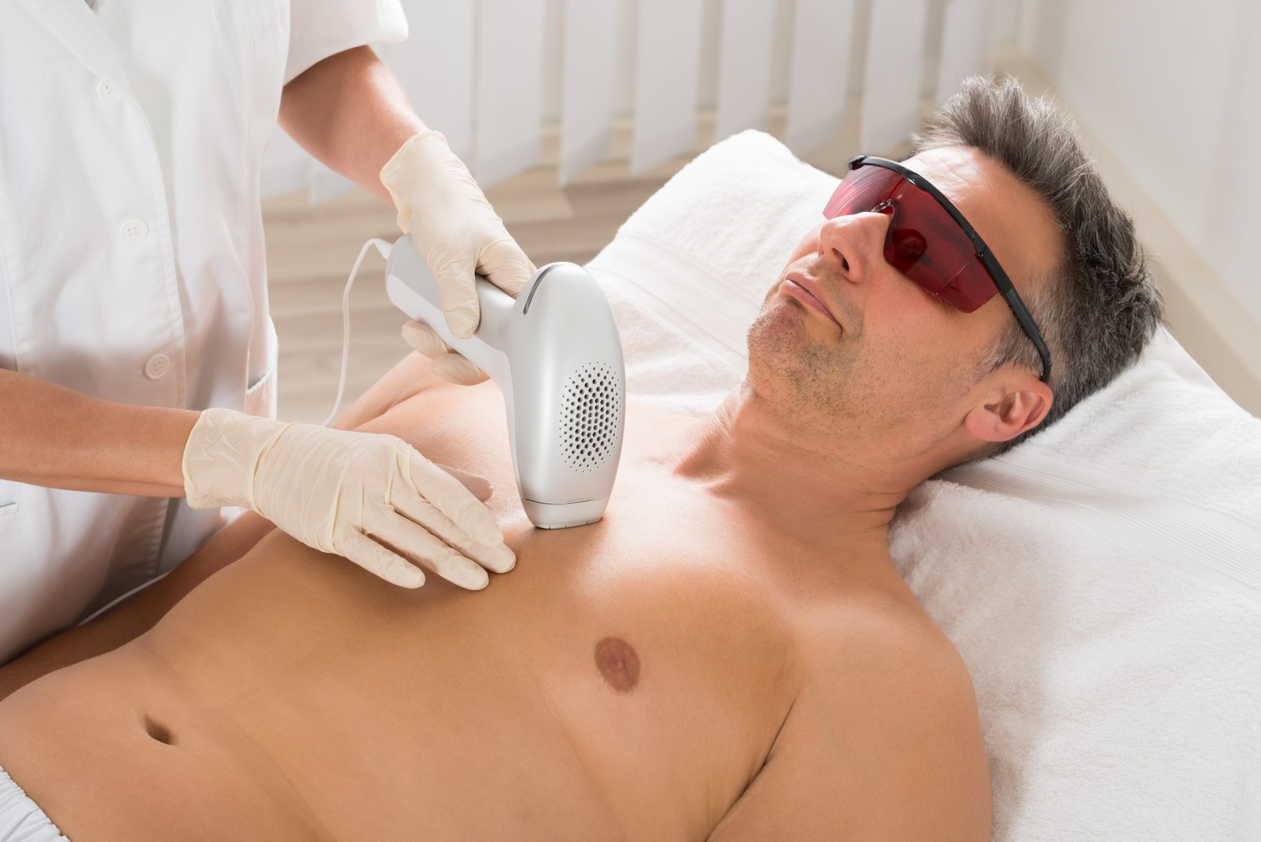 Best-Laser-Hair-Removal-Vancouver